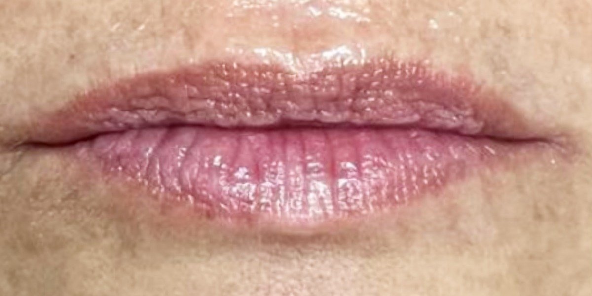 Antes